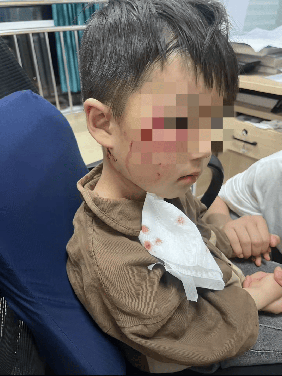 3岁男童被狗咬伤去世,接种狂犬病疫苗为何还会病发?