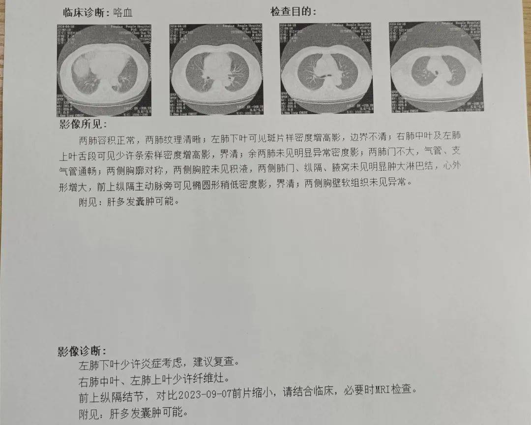 癌症早期单子图片图片