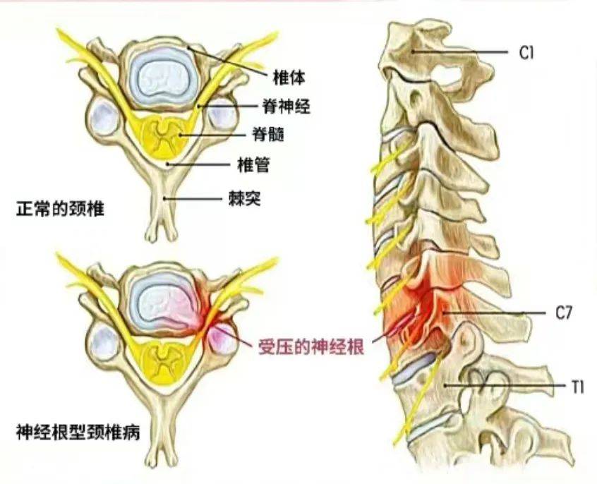 脊柱的构造与组成图片图片