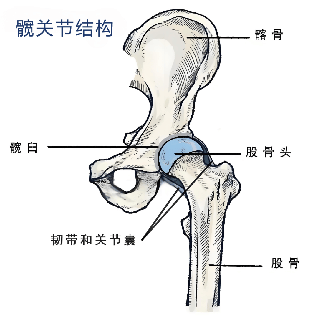 股骨头位于大腿骨的上端;髋臼是骨盆骨前下方的凹形结构,与股骨头相