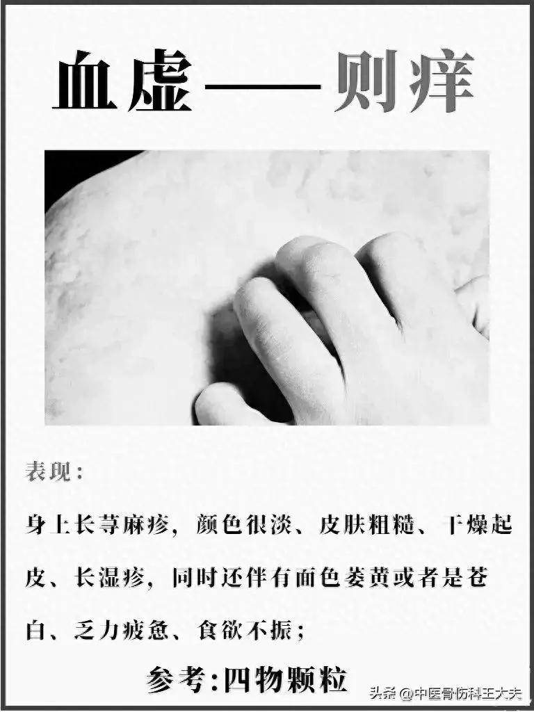 血虚,血热,血寒,血瘀分别有什么症状?