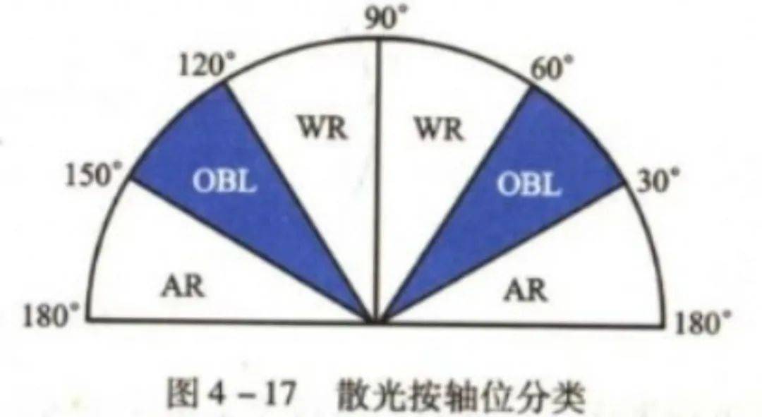 散光度数参考值图片