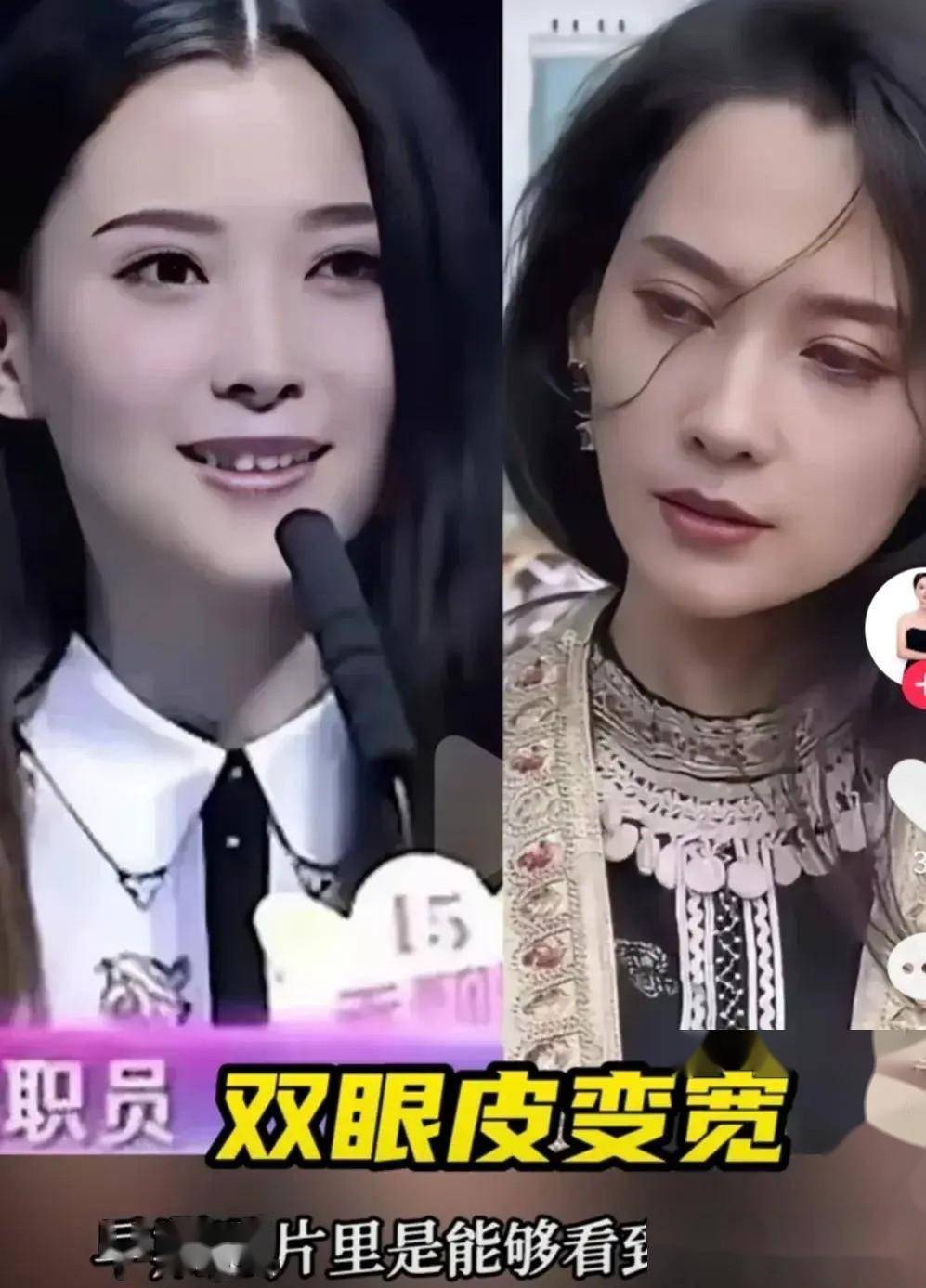 森林北(李巧)到底有没有整容?看她前后的照片对比就知道答案了