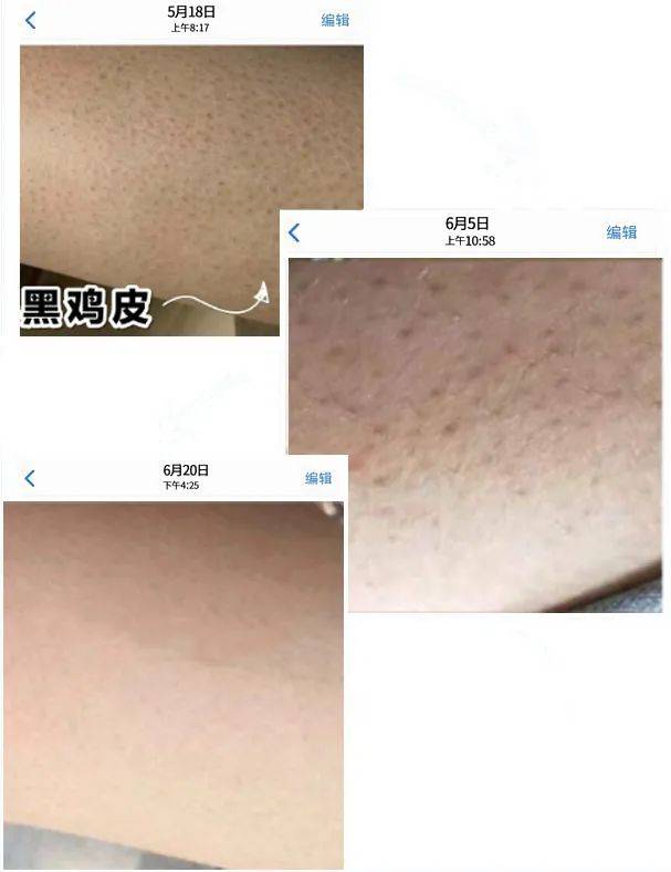 用了这款39元/4罐的磨砂膏,你就是行走的人间水蜜桃