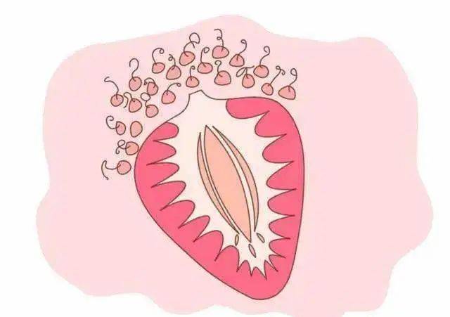 外阴长颗粒图片