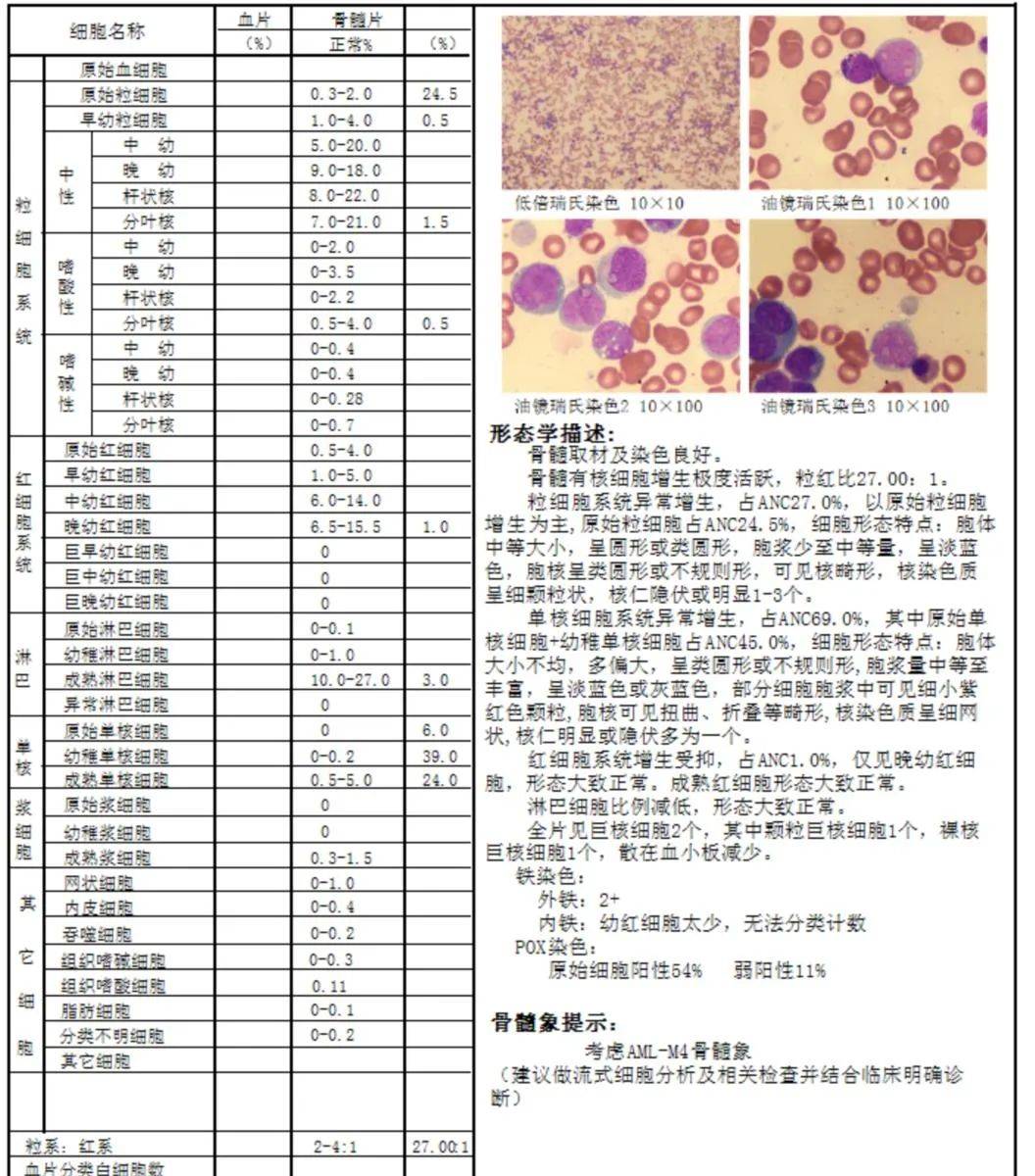 白介素4低图片