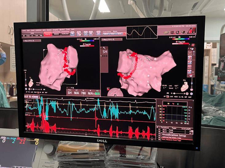 朝阳医院核磁加急-北京朝阳医院核磁共振价格表 