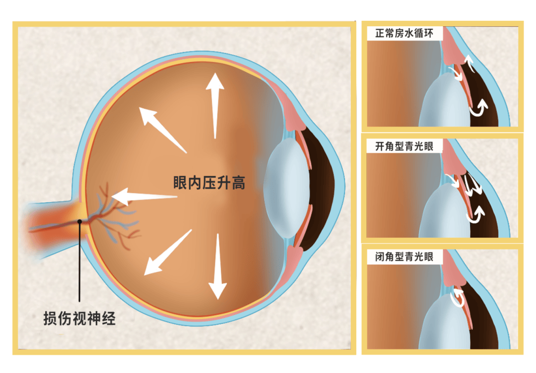 这点很重要._眼球_眼睛_情况