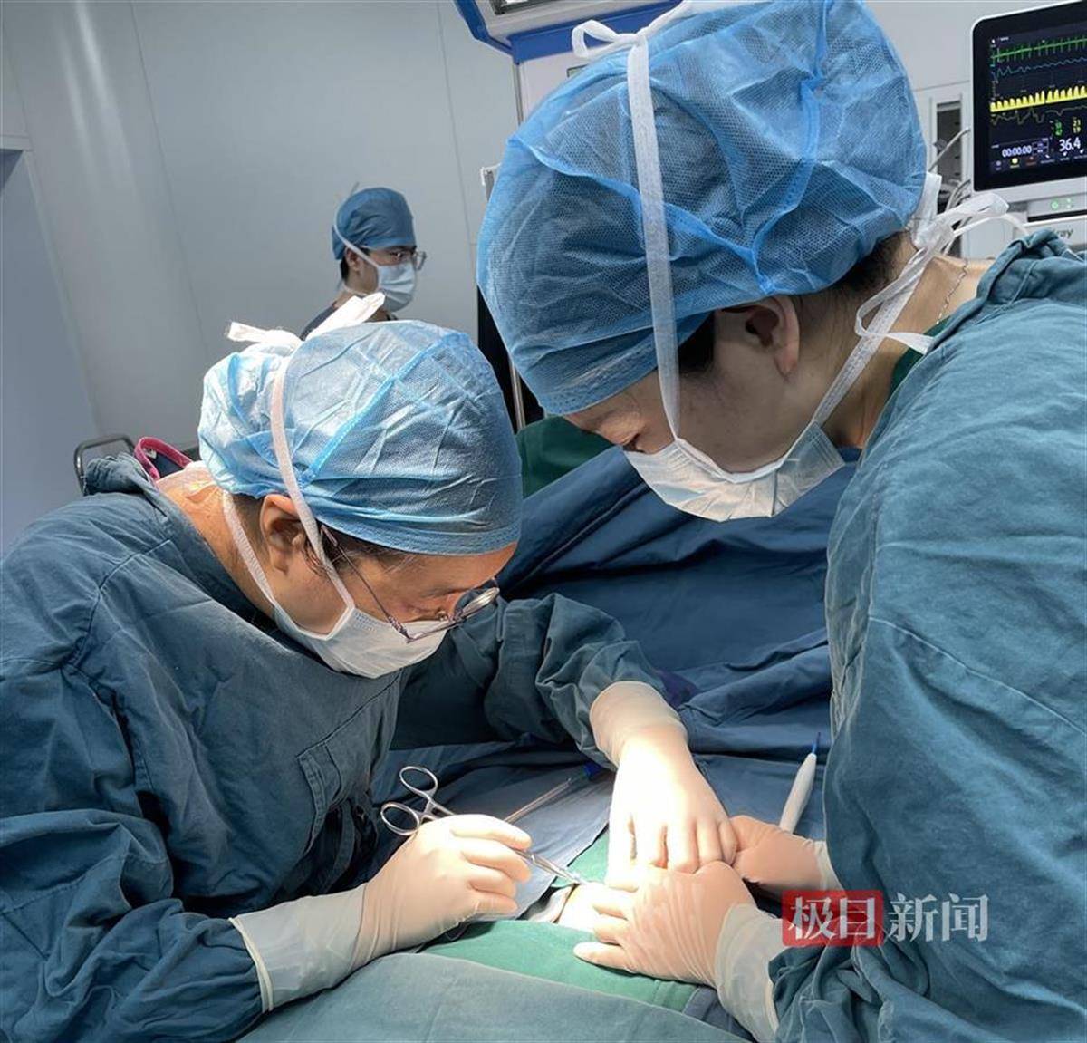 大半脏器"跑"到"肚子"外,宝宝一出生便上手术台_曾女士_吴晓娟_医生