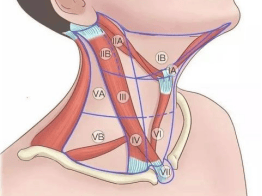 通常甲状腺乳头状癌发生淋巴结转移的部位以颈部vi区为主,其次为iii区