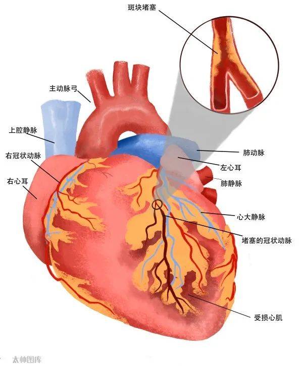 冠脉的位置图图片