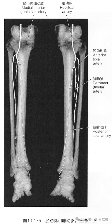 下肢动脉断层解剖图图片