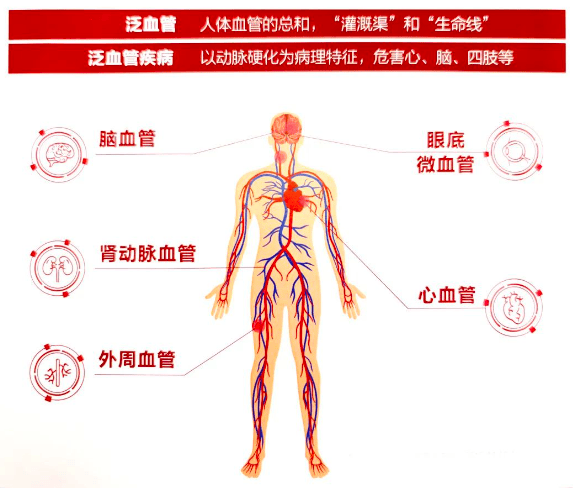 专家串珠成线 数据把脉健康——打造泛血管疾病管理的“济南样板”_患者_诊疗_医生