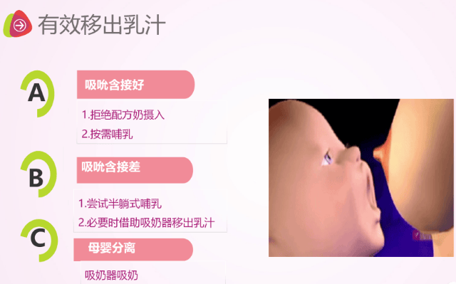生理性涨奶的"酷刑" 懂的都懂