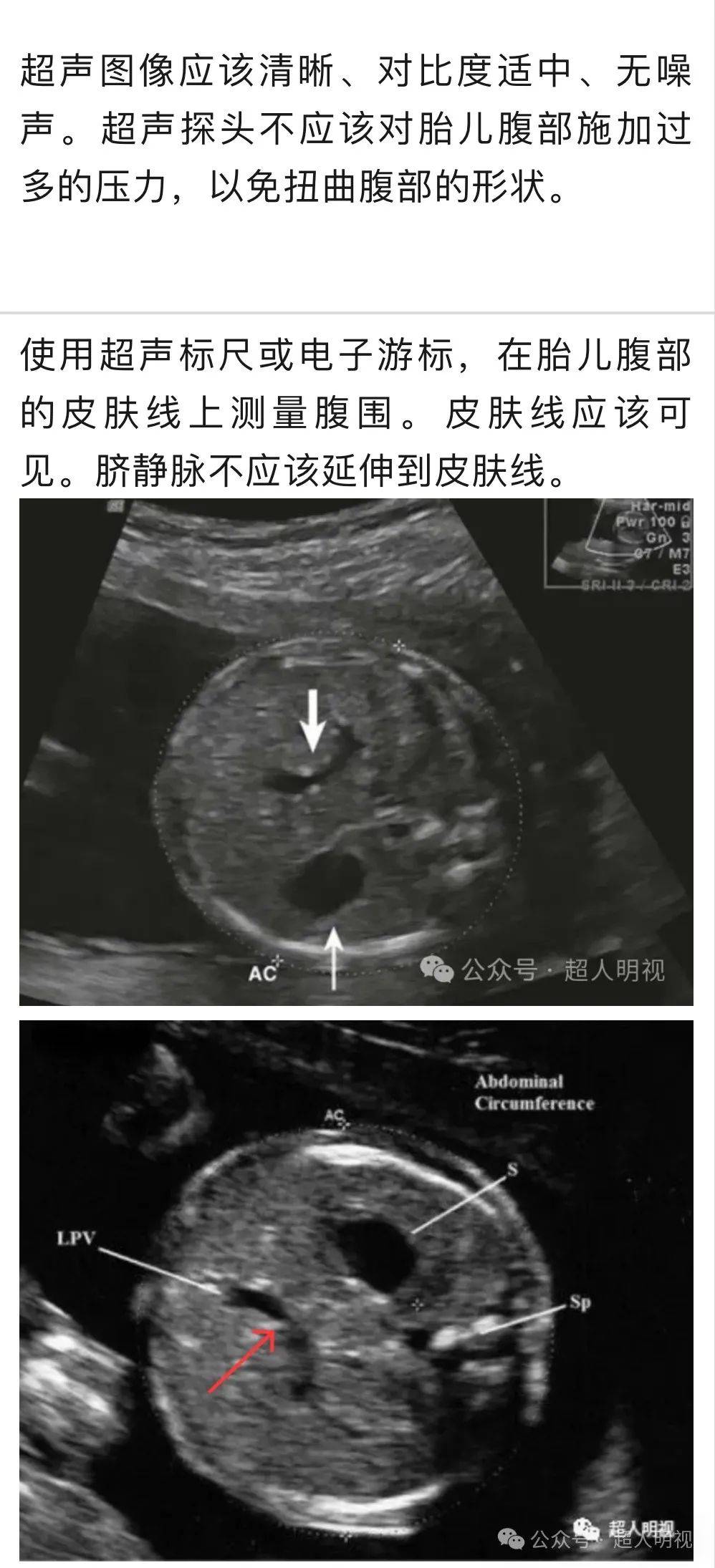 1, 胎盘功能不全引起的fgr,腹围ac小具有最大的预测价值.