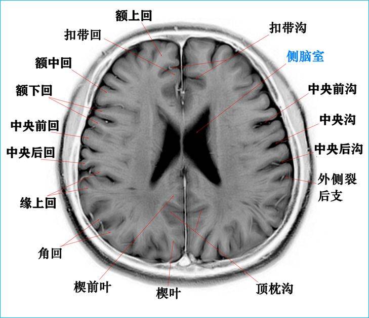 头部横断层解剖图图片