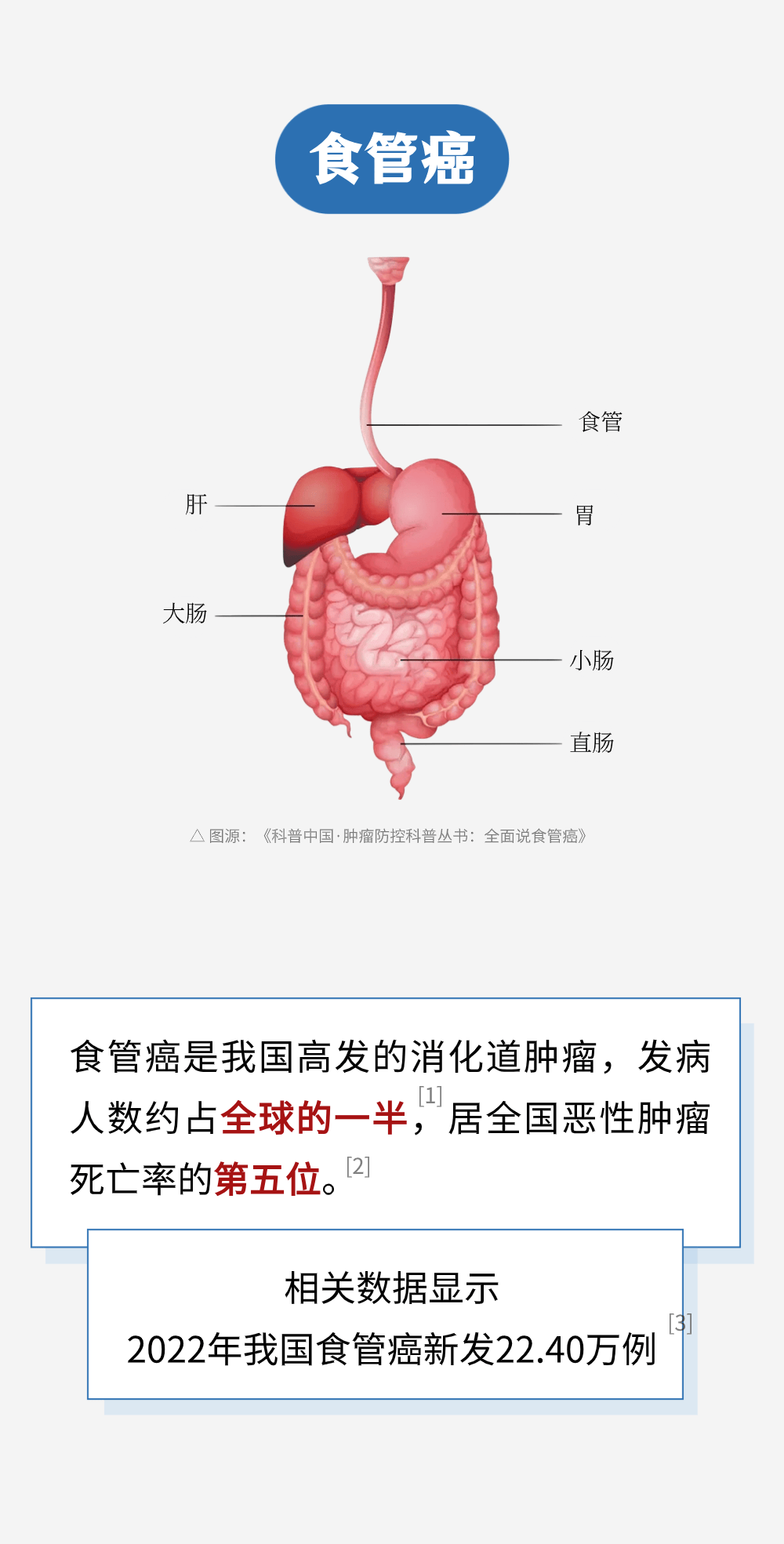 食道癌是怎么引起的图片