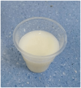 她每天喝的是清水,但拉出来的尿尿总是呈乳白色,就好像牛奶一样.