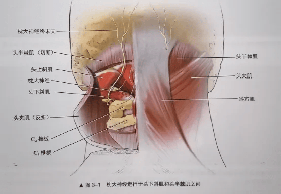 枕神经痛怎么处理?看完这篇全都懂了