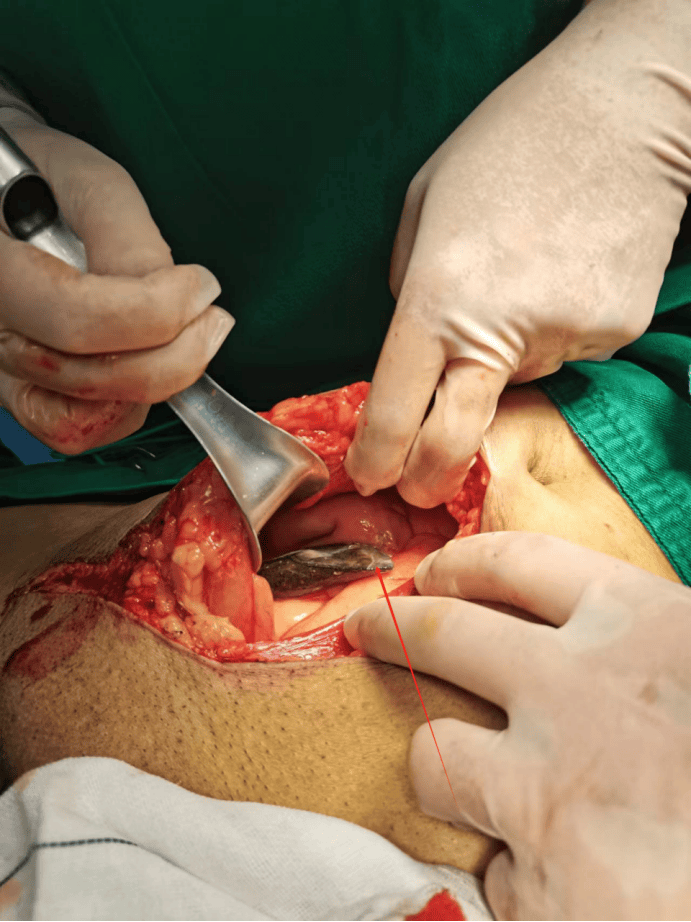 云县人民医院创伤中心:多学科联合救治 创造生命奇迹