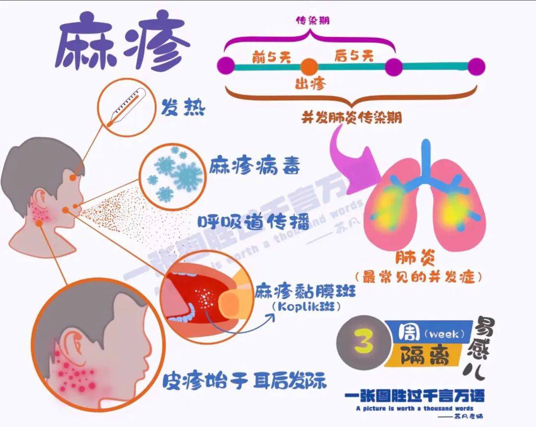 如果是易感个体,如未接种过疫苗的儿童,在接触麻疹病毒后72小时之内