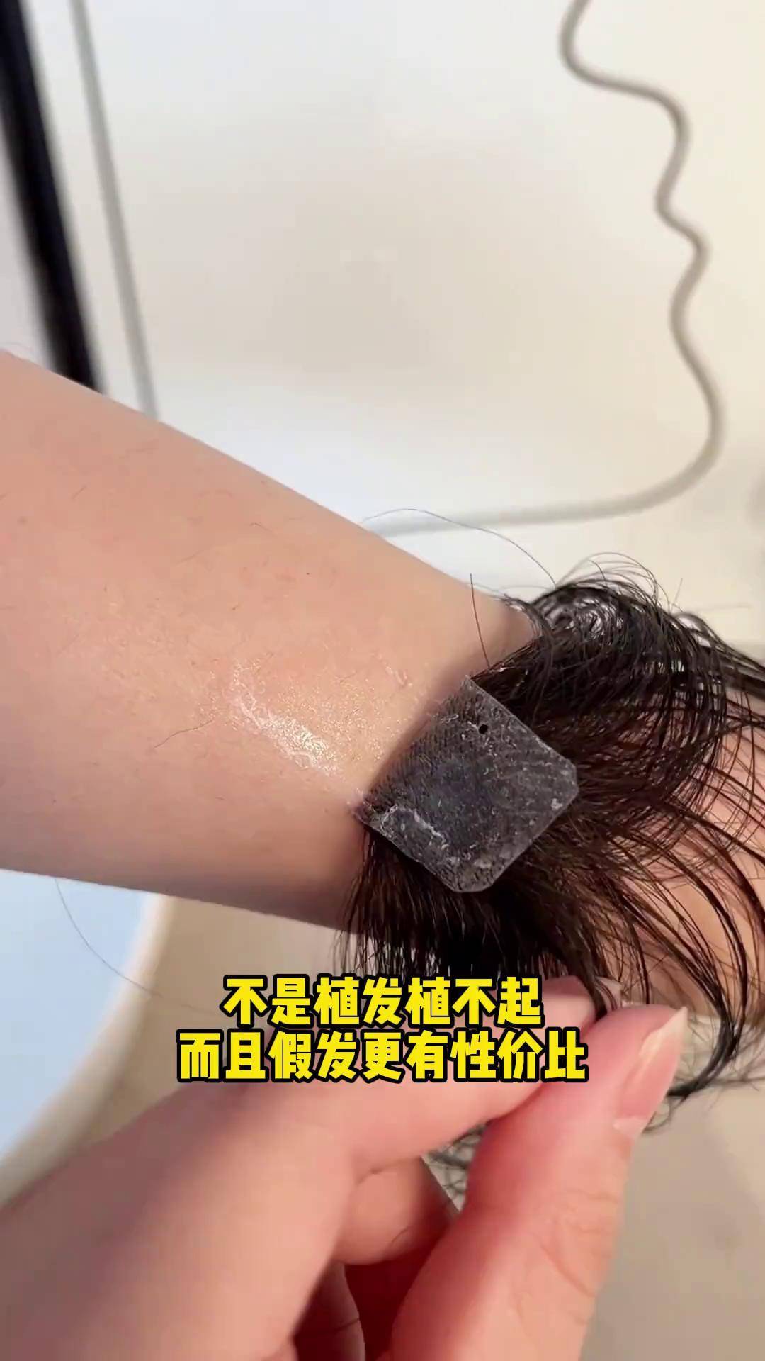 植发后可以带假发吗(植发后可以戴假刘海吗)
