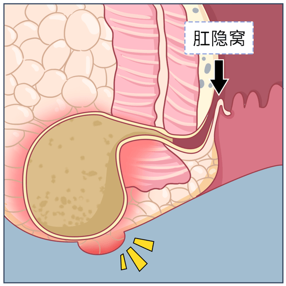 肛门与肠道结构图片图片