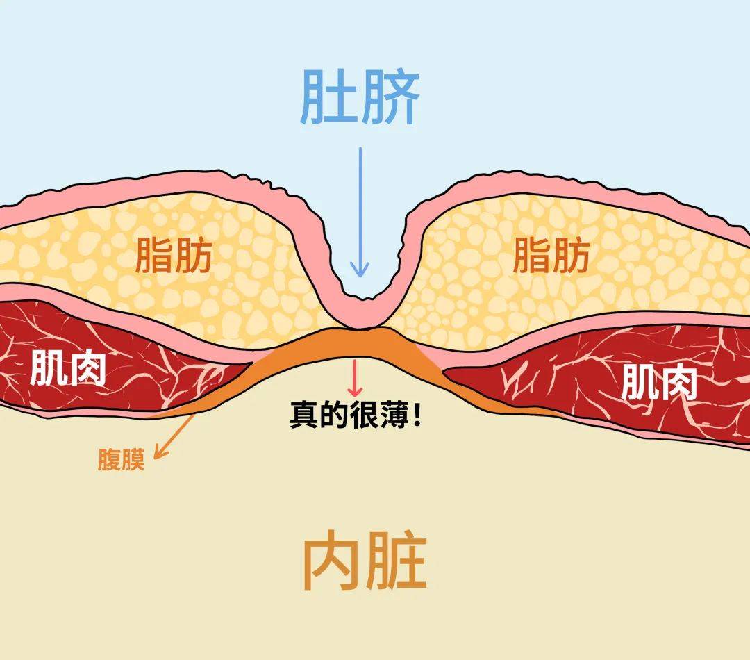 小腹和少腹示意图图片