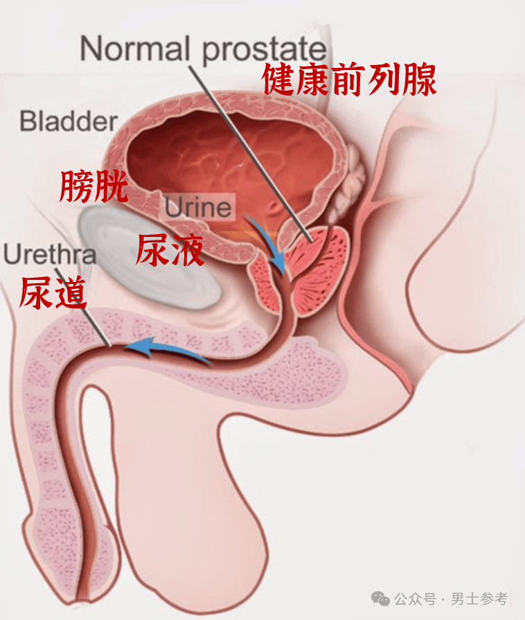 尿道瘢痕图片