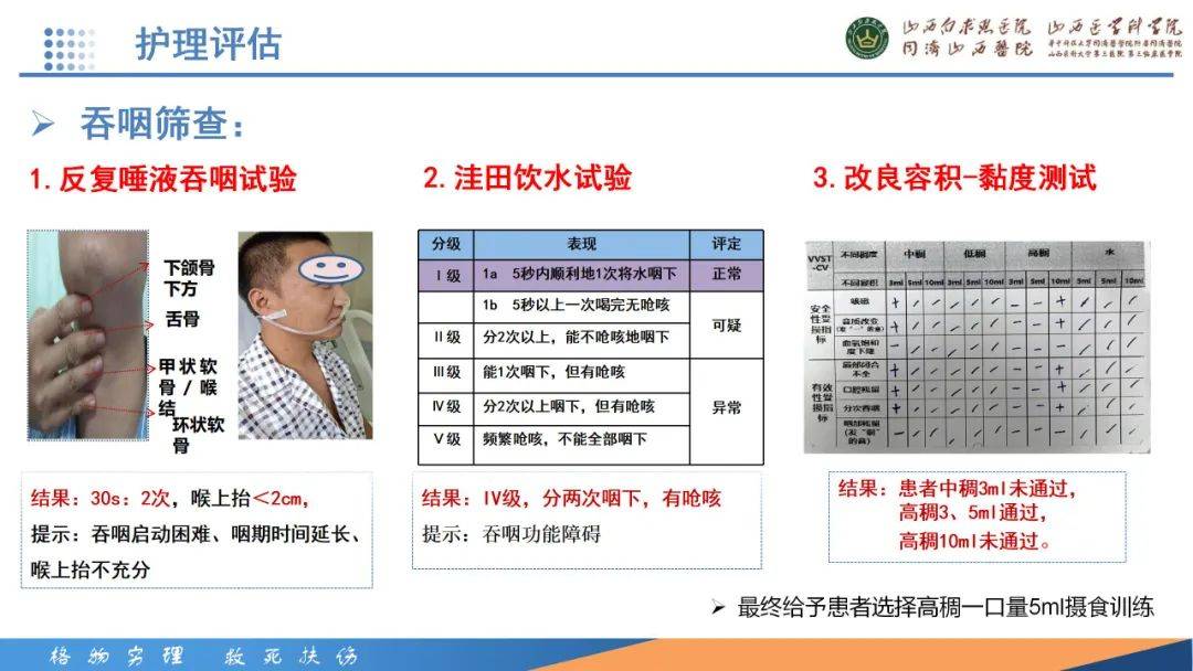 洼田饮水试验ppt图片