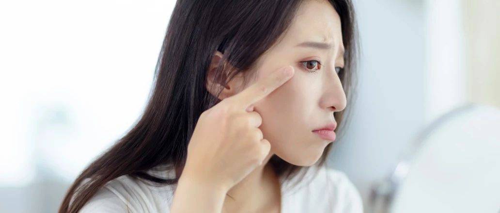 眼周细纹?请这样处理_皮肤_美容_皱纹