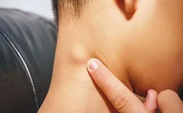 的一个信号,尤其是如果这种肿胀逐渐变得明显,或者伴随着其他不适症状