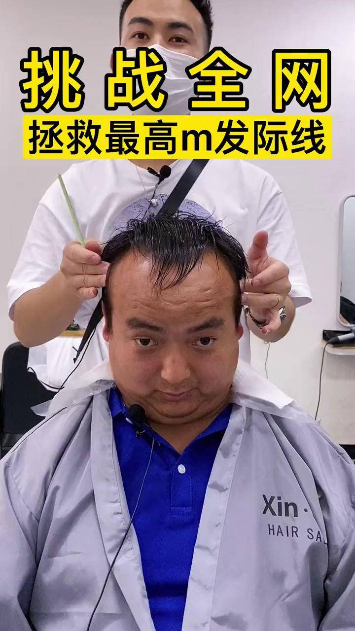 脸大,脸圆,超高 m发际线,今天来挑战全网高发际线 男士发型设计 男士