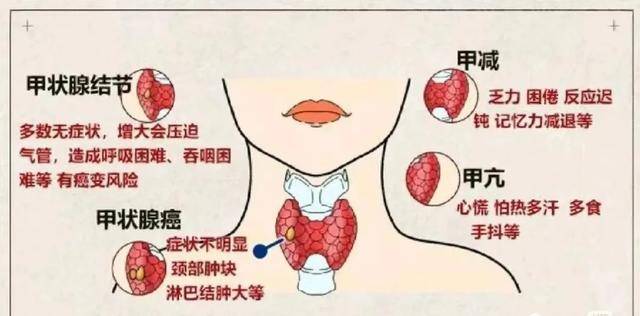 甲状腺纤维瘤、甲状腺肿大、甲亢，不用怕！咱老百姓有验方
