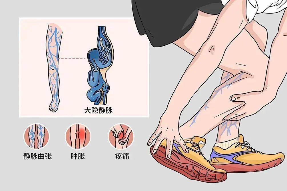 烂腿的原因造成的图片图片