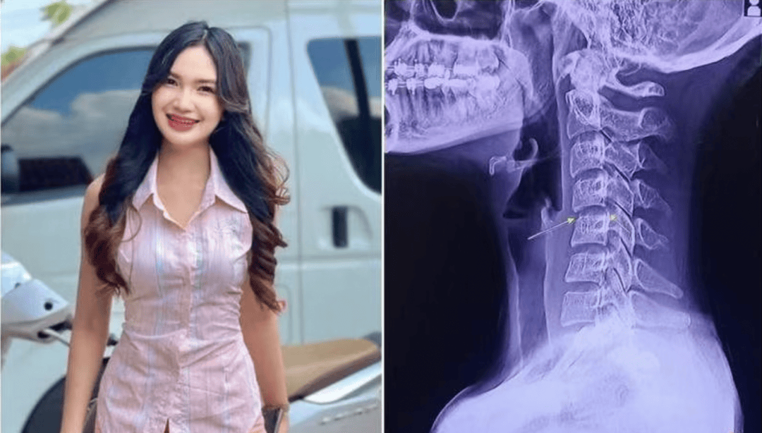 女歌手3次泰式按摩后因败血症离世！|泰式按摩|泰式按摩和中式按摩有啥区别|泰式按摩是什么意思