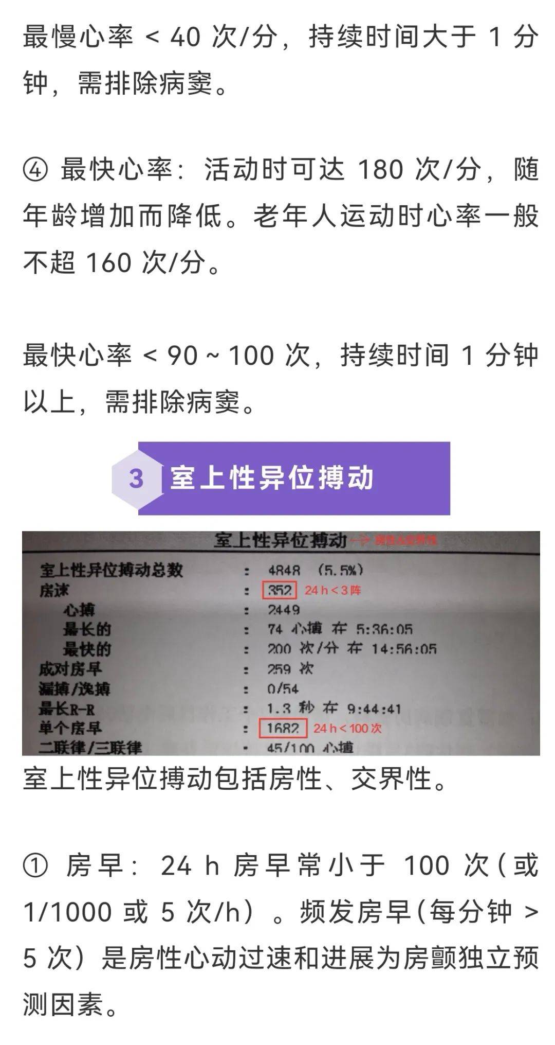 24小时心电图指标解读图片