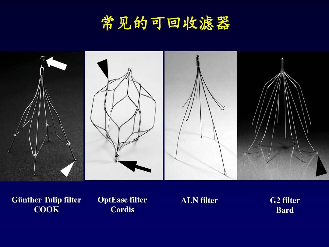 关于下腔静脉滤器植入术,你了解多少?
