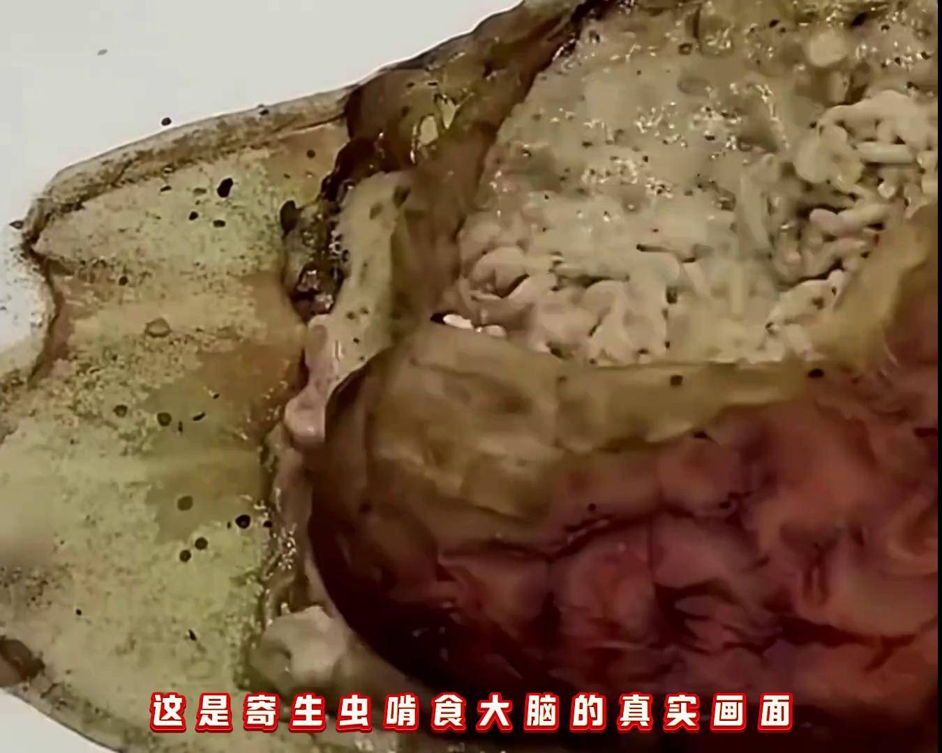 这是寄生虫啃食大脑的真实画面这些微小的虫子,虽然体积只有二十微米
