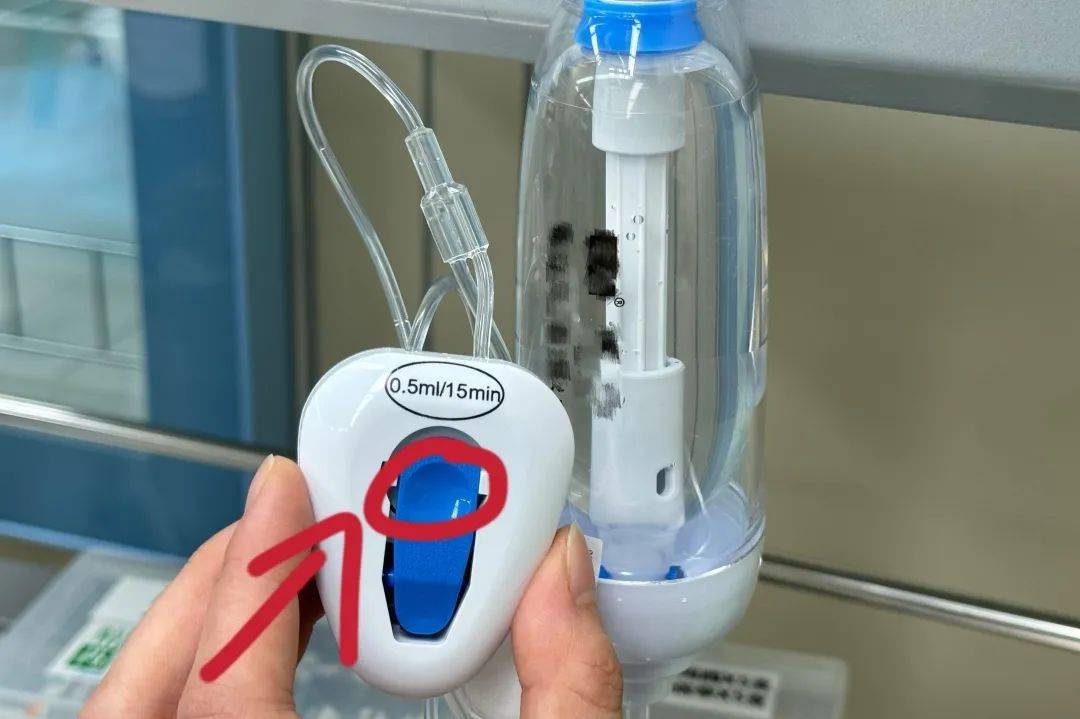 告别术后疼痛,镇痛泵来帮忙!