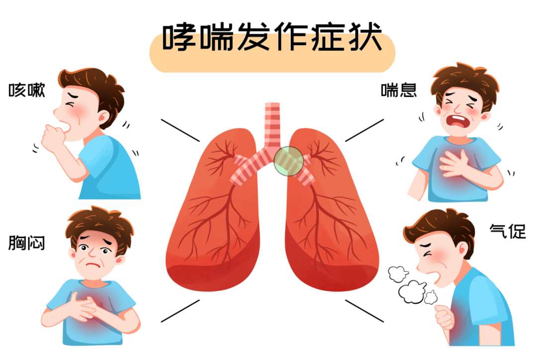 远离"会呼吸的痛",科学防控哮喘,这些知识要知道