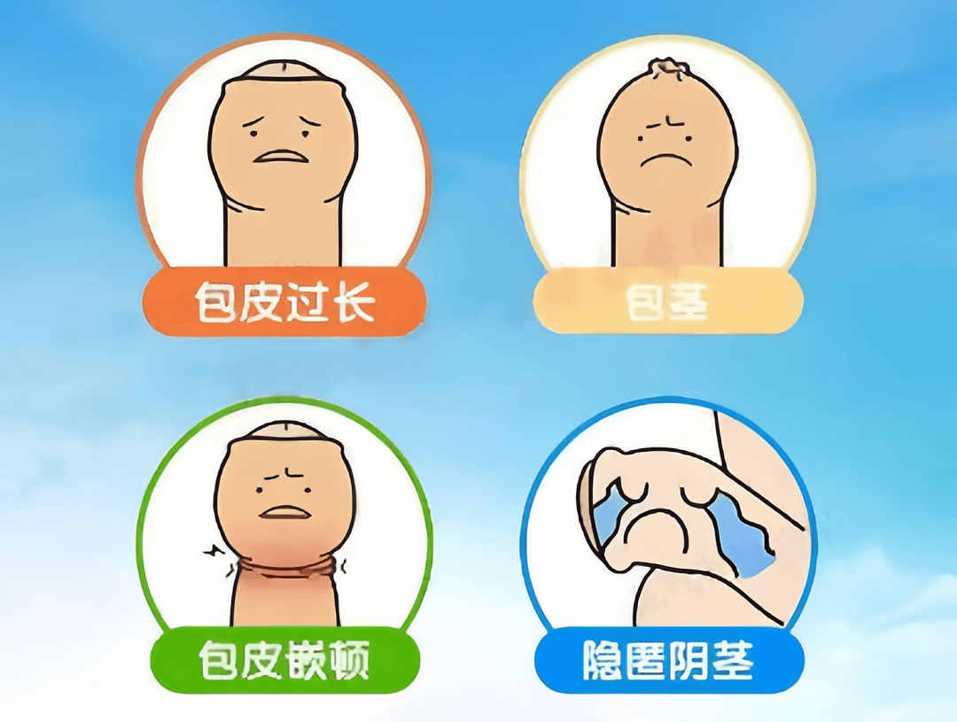 前列腺炎：男性健康的隐形杀手