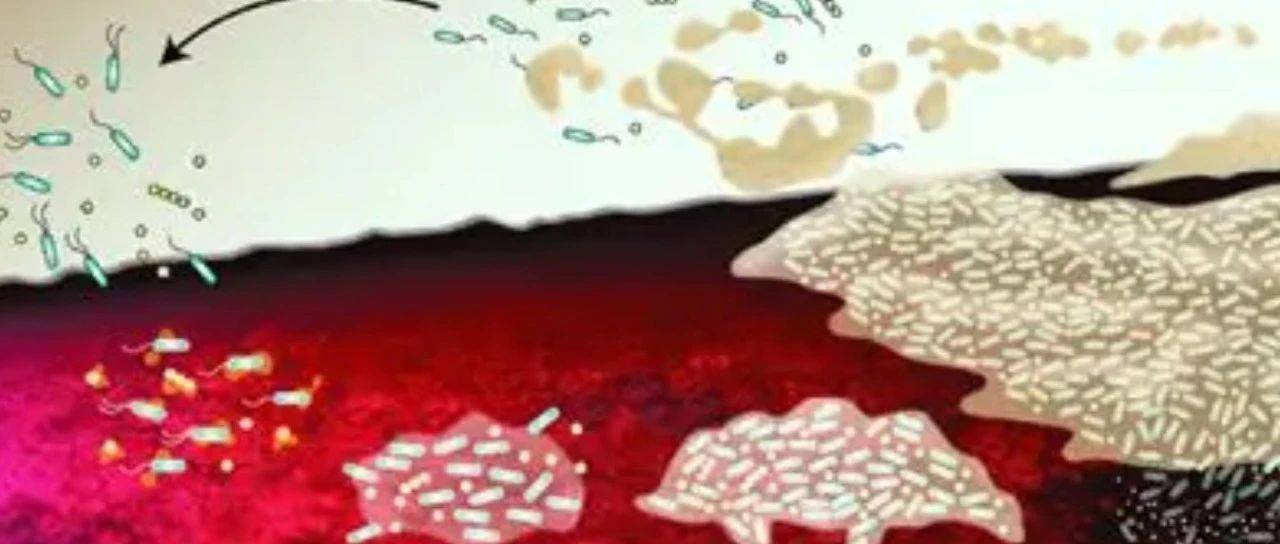 亚太清创共识之清创与生物膜管理_细胞_敷料_伤口