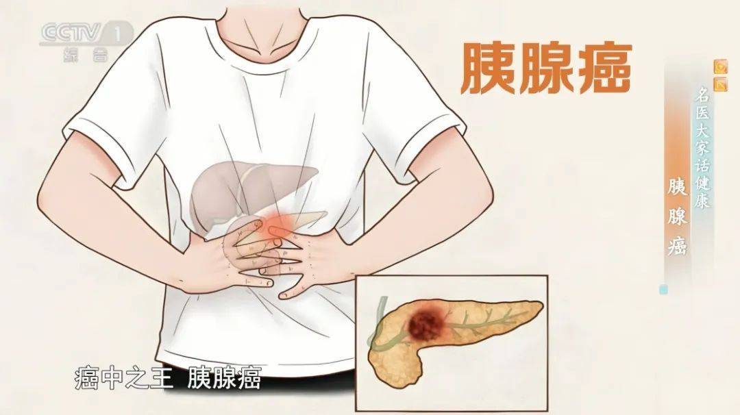炎症是“小病”？别拖，小心发展成“癌中之王”！做好这5件事，癌细胞都怕你