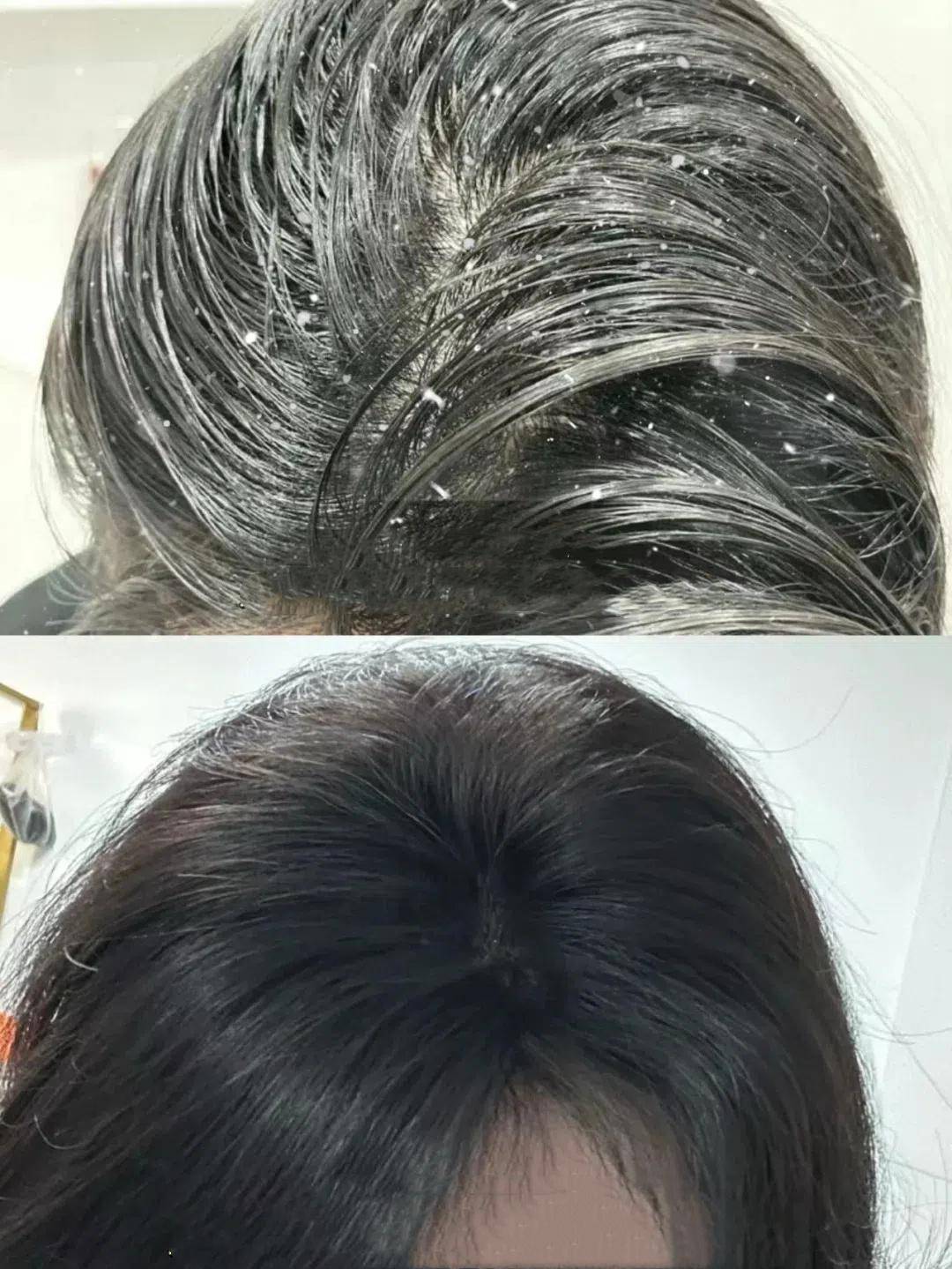 女士去屑洗发水品牌评测