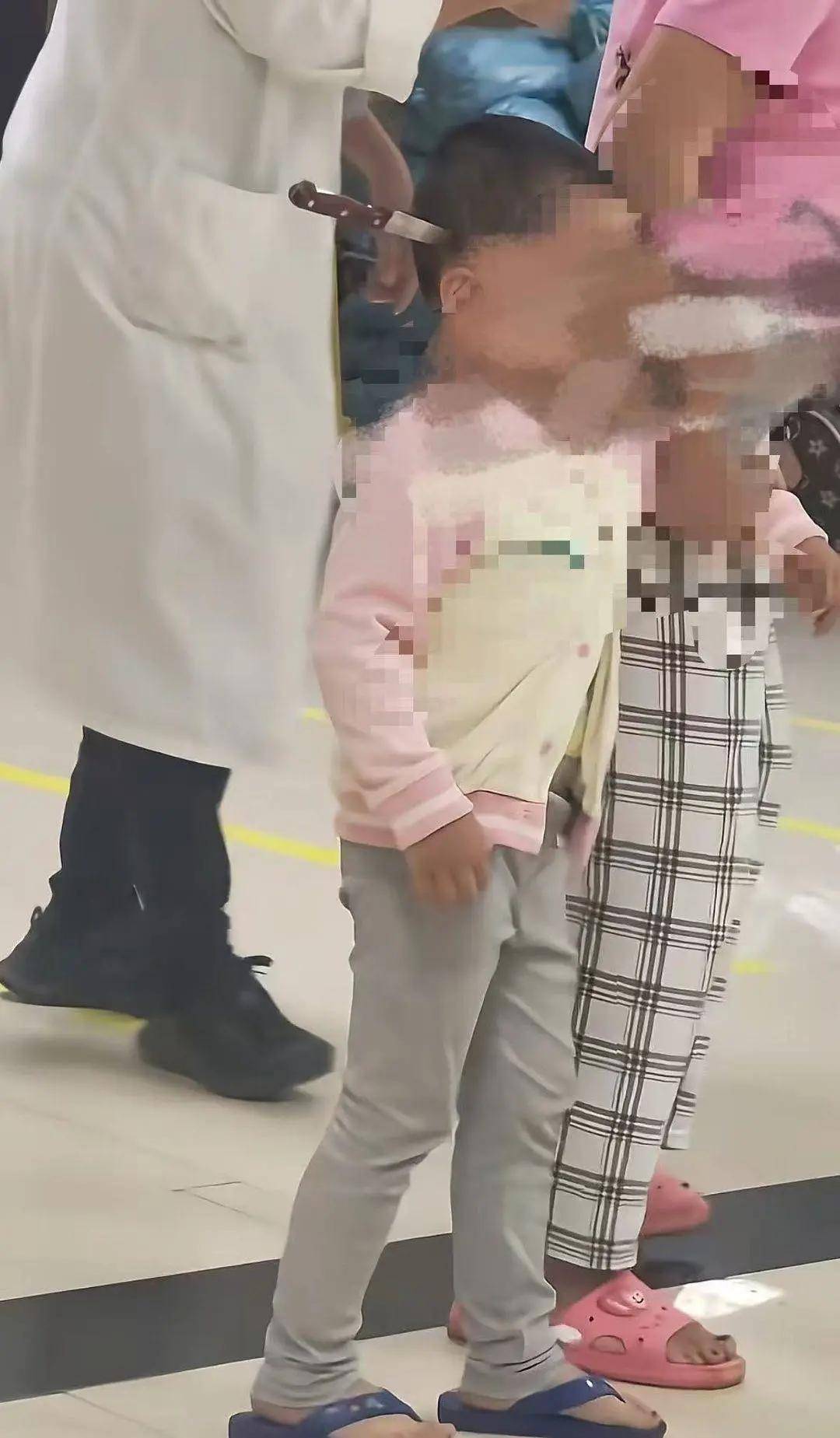 云南一3岁女童“头上插刀”淡定就医，医院：已做开颅手术，成功取刀，女童身体情况稳定