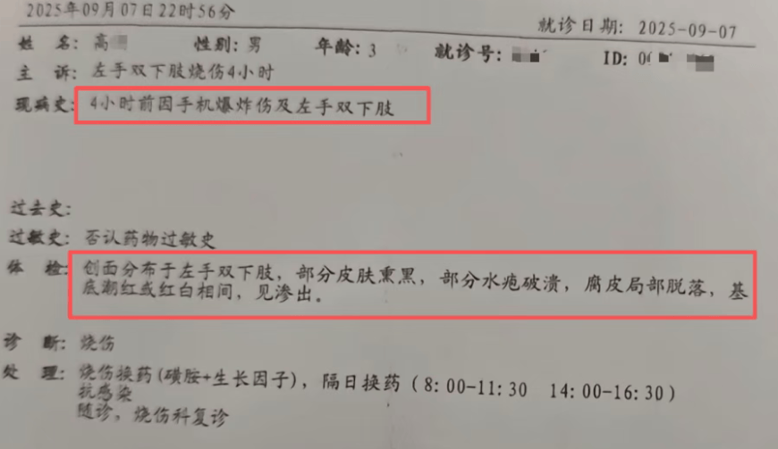 手机突然爆炸，3岁男童被烧伤！