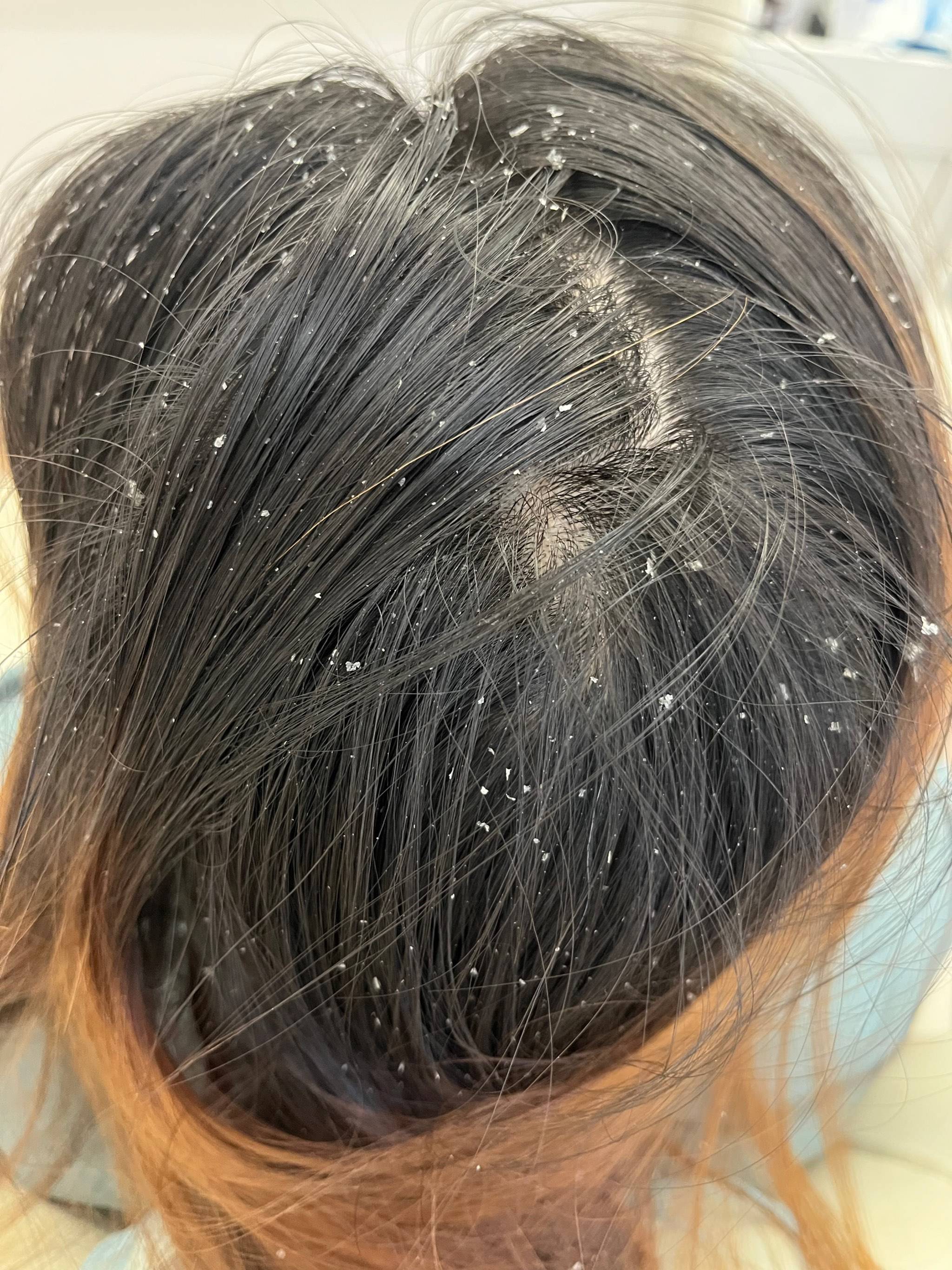 头发怎样能蓬松起来?男士去屑就选它