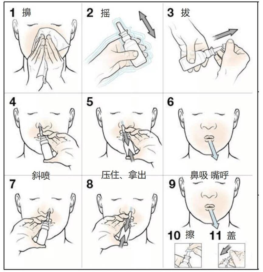 季节交替,鼻炎又来了!如何预防,给您支招!