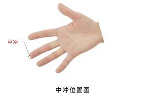 中冲穴:指尖上的“急救开窍穴”!名医偏爱、定位用法全攻略_突发_小儿_内热